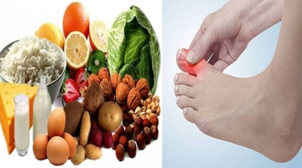 Fruits That Cause High Uric Acid Swollen Fingers Nausea Joint Pain Identify Acidic Symptoms In Body