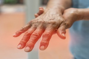 Diabetes Symptoms On Hand