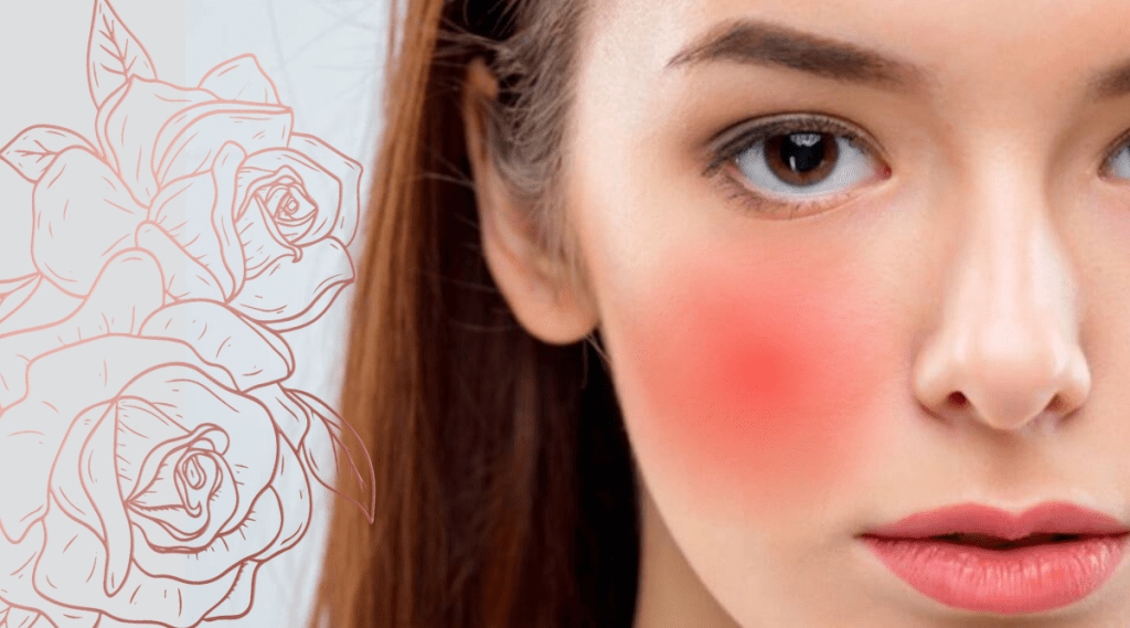 how to heal facial redness
