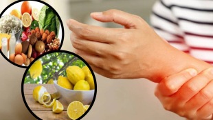 Uric Acid Home Remedies Ayurveda Says Eat lemon With These Dishes for instant relief Avoid Heart And Kidney Failure