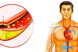 how to increase good cholesterol