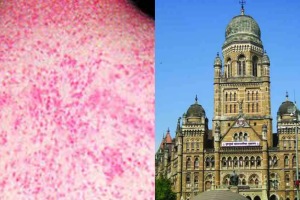 Mumbai Municipal Corporation will spread awareness about measles and vaccination through wrappers