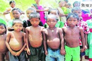 Malnutrition rates in india