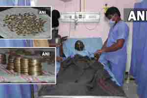 karnataka patient swallows coin
