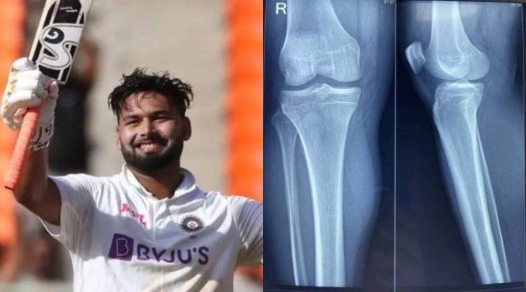 Rishabh Pant Ligament Repair