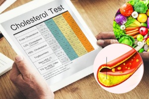 How To Reduce Cholesterol Four Best Foods To Control Bad Cholesterol Know The Foods List From Expert