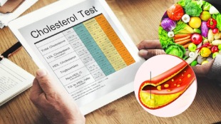 How To Reduce Cholesterol Four Best Foods To Control Bad Cholesterol Know The Foods List From Expert