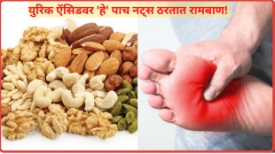 Dry Fruits That Reduce Uric Acid How Much Cashew Almonds Should be Consumed in a Day Health News