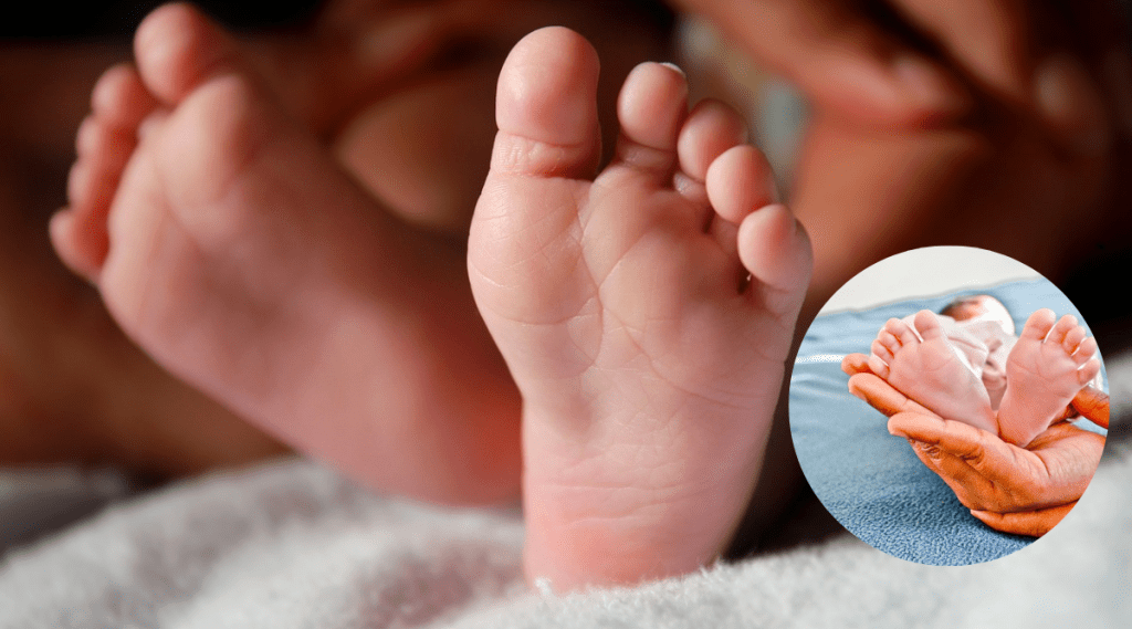 Girl Born With Four Legs Viral Photo Shocks Internet Extremely Rare case of Birth