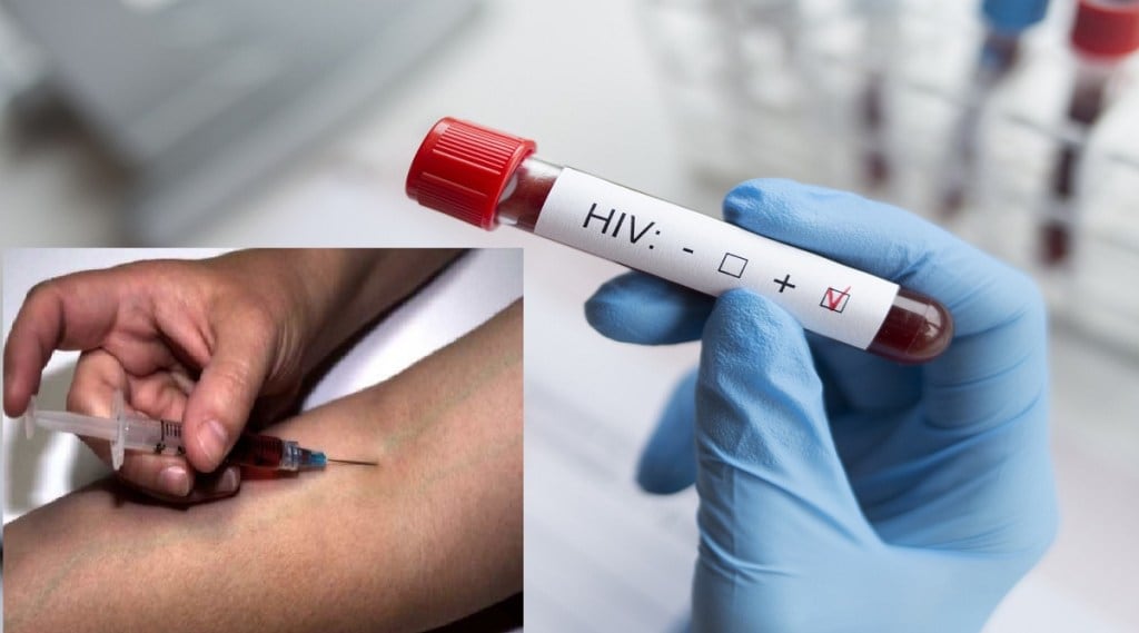 HIV injection