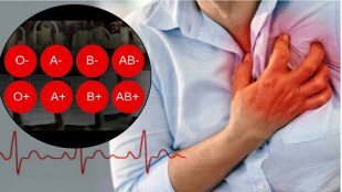 heart attack causes