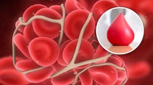 blood cloting sign
