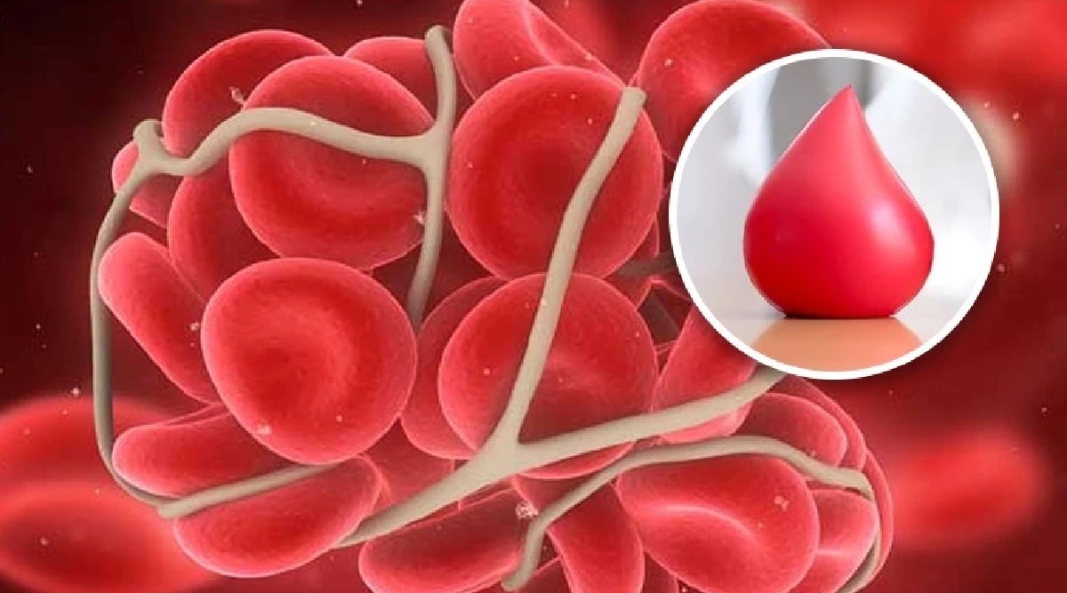 blood cloting sign