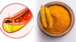 हळदीच्या सेवनाने झपाट्याने कमी होईल खराब कोलेस्ट्रॉल? फक्त वापरण्याची पद्धत एकदा जाणून घ्या