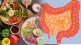 worst foods for digetion