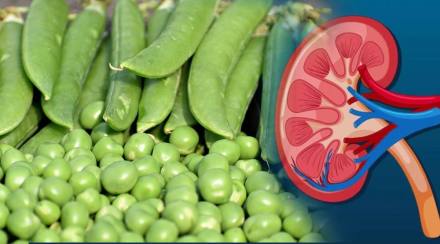 Eating Green Peas Cause Kidney Failure How To Know If Uric Acid Increased in Body Symptoms in Legs