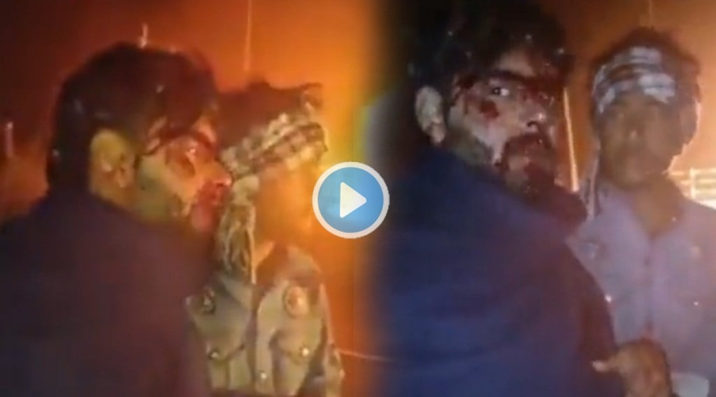 Rishabh Pant Accident Video: पंतचा अपघातानंतरचा पहिला व्हिडीओ आला समोर, रक्तबंबाळ अवस्थेत रस्त्यावर होता उभा