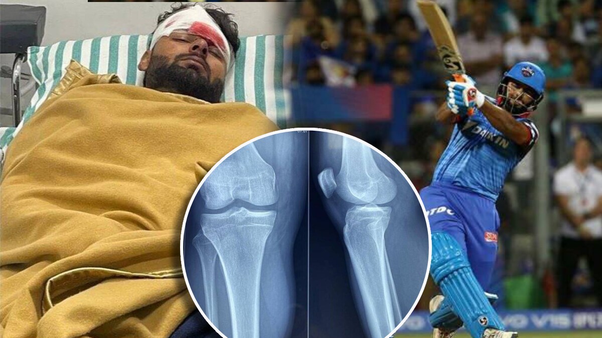 Rishabh Pant Health Update