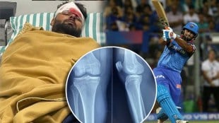 rishabh pant health updates