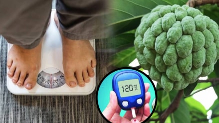 Diabetes Patients Can Eat Custard Apple Does It Increase Weight and PCOD Signs Know The Truth From Expert