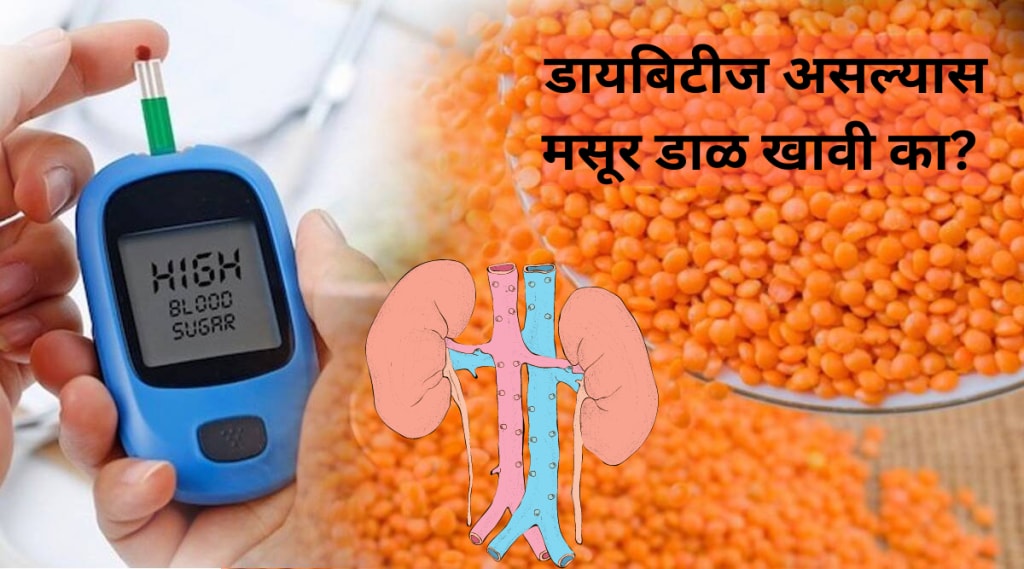 Health News is Masoor Dal Good To Control Diabetes Blood Sugar Kidney Disease Weight Loss Remedies at Home Expert