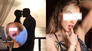 Boyfriend Cuts Girlfriend Tongue While Kissing Had To Do Surgery Famous Model Ceyda Ersoy Shares shocking Incident