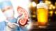 Does Beer Cures Kidney Stone Spot These Signs Of Kidney Failure Know From Expert