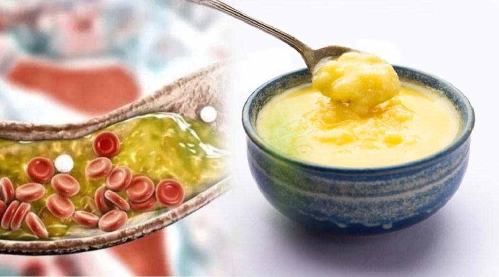 Ghee For Cholesterol