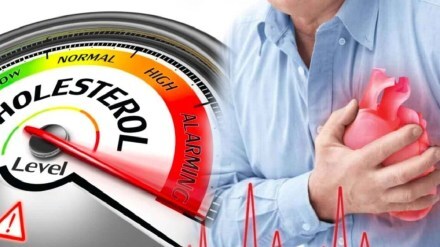 cholesterol causes