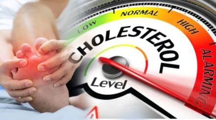 High Cholesterol Level 5 Signs And Symptoms Of Seen In The Feet and Hand Know From Health Expert