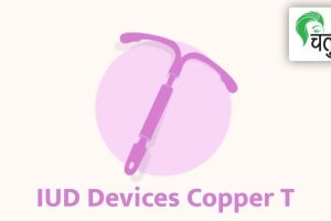 IUD devices copper T