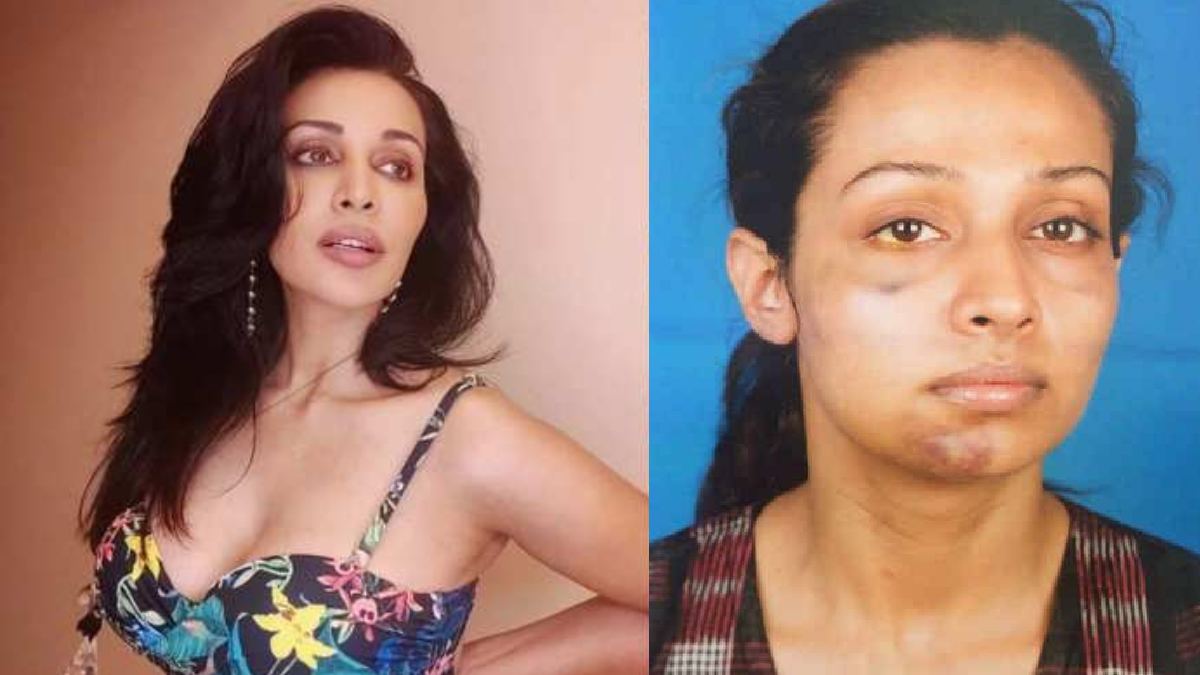 flora saini