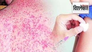 rubella cases in maharashtra