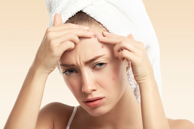 sleeping mistakes cause pimples