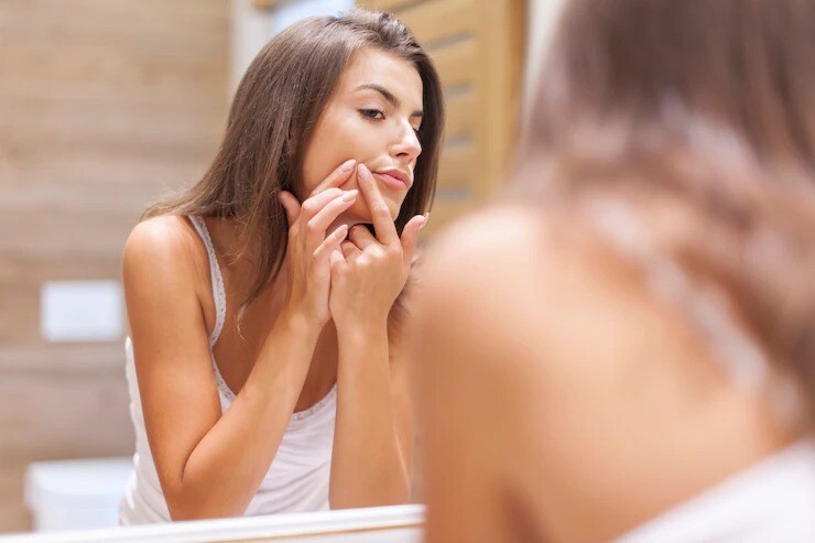 sleeping mistakes cause pimples