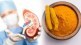 kidney failure symptoms