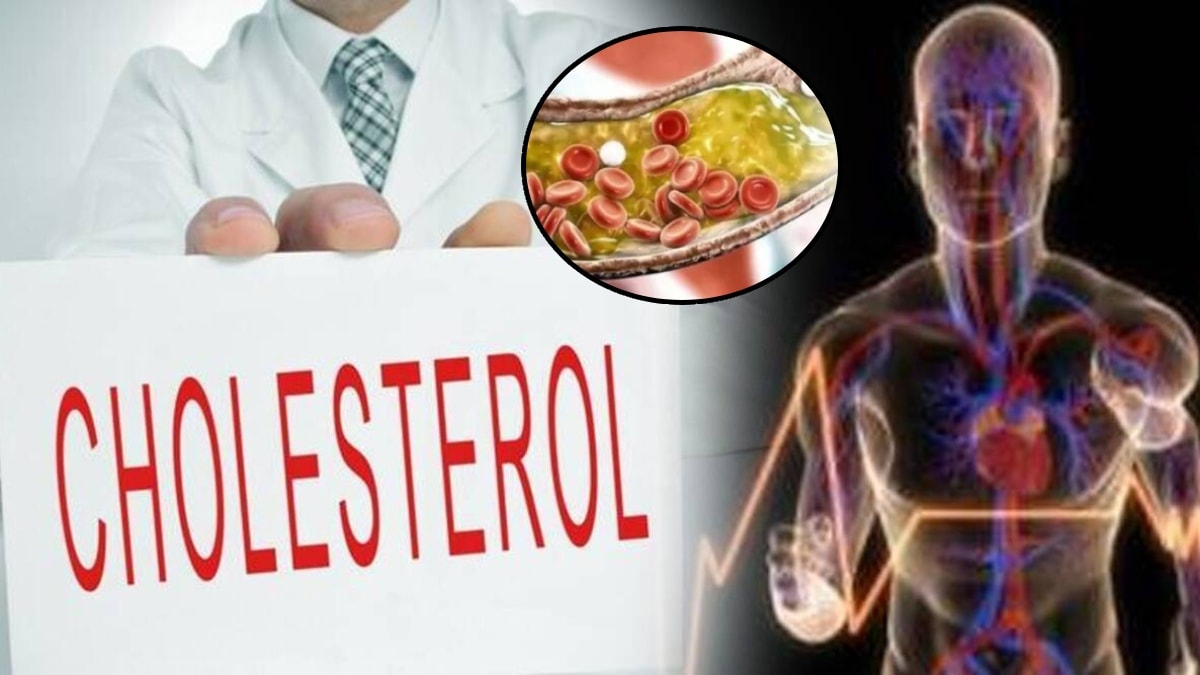 cholesterol problem