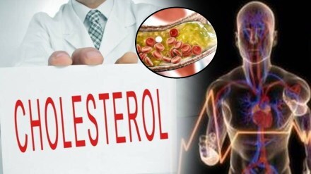 cholesterol problem