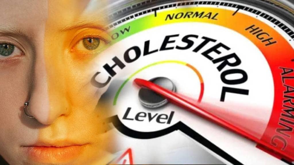 If Bad Cholesterol Increased Your Face Gives These Signals How To Reduce Cholesterol In Body Blood Vessels Expert Advice