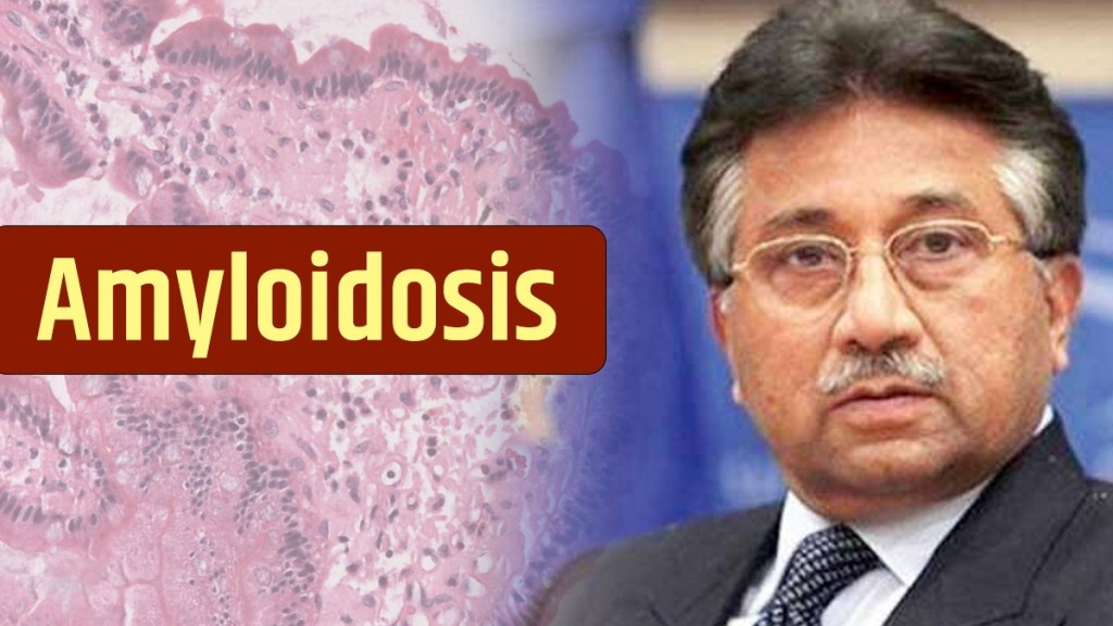 pervej musharraf death amyloidosis disease