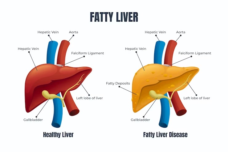 liver healthy food