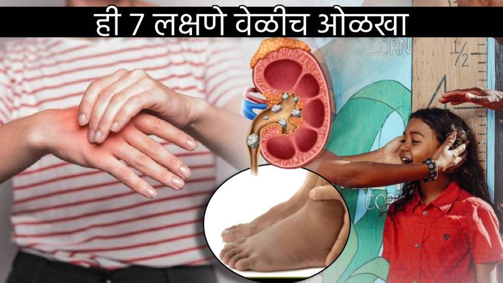 Chronic Kidney Failure Shows This Seven Signs In Body Before Kidney Stops Working How To Identify Danger In Kids Health News