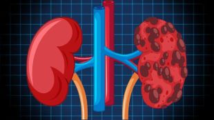 tips for dialysis patients