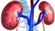 Kidney transplants
