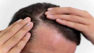 Can lack of B12 cause hair loss