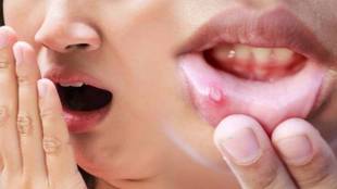 oral health