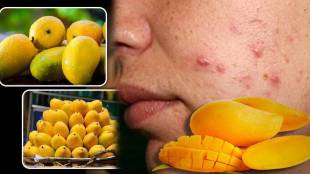 Can Mango Really Cause Acne Pimples Myths Busted by Dietician How Alphanso Can Benefit Body Skin