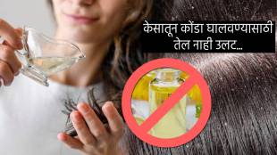 Get Rid Of Dandruff Permanently In Just Two Weeks Dermatologist Explains Why Not Deep Oil Hair shampoo For rapid hair growth
