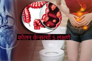 Colon Cancer Early Signs Extreme Tiredness Constipation Irregular Bowl Movements How To Identify Cancer at early stage Health Expert