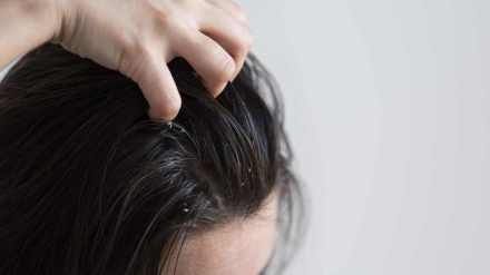 Reasons your hair gets oily even after washing it